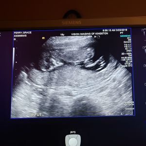 Meet your Posher, Grace